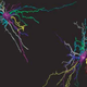 Illustration for article titled Is your depression caused by brain inflammation?